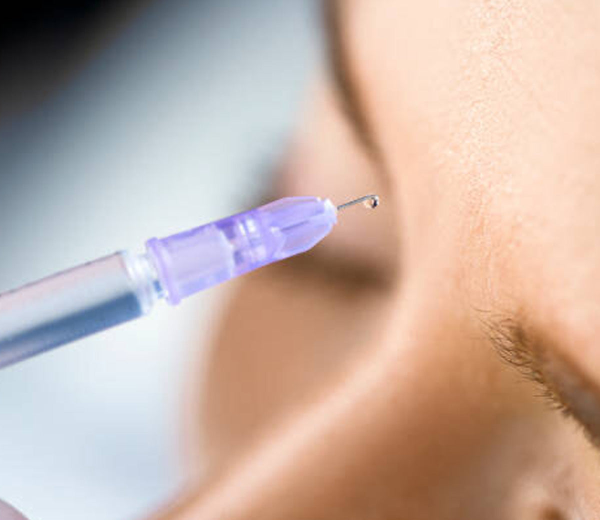 Anti-Wrinkle Injections in Dorset & West Hampshire: Your Questions Answered